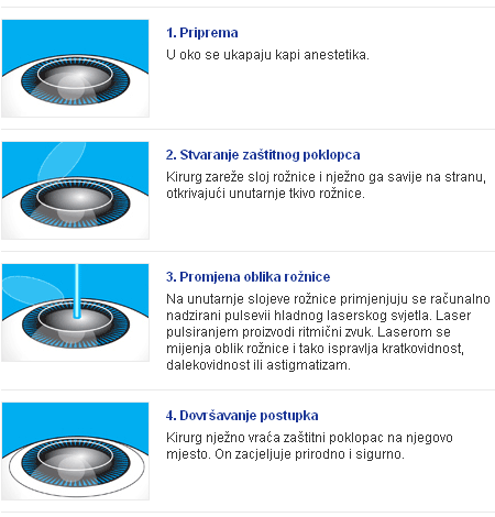 Lasik metoda